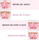 Wchiuoe Umbilical Hernia Belt, Baby Belly Button Band, 2pcs Children Infant Baby Umbilical Hernia Belt, Infant Abdominal Binder, Adjustable Baby Navel Truss Support Abdominal Belt (Pink) - Image 3